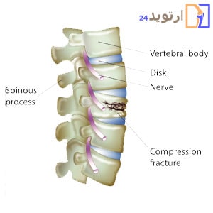 Types-of-bone-diseases-and-their-treatment-min